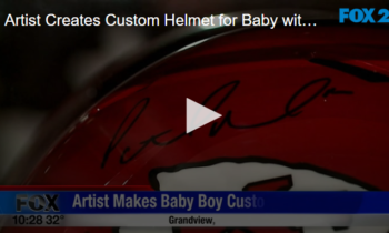 Artist Creates Custom Helmet for Baby with Condition