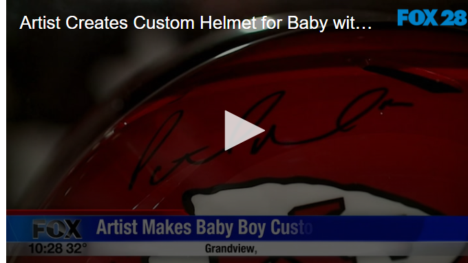 Artist Creates Custom Helmet for Baby with Condition