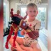 5-year-old boy becomes youngest to ever receive bionic arm