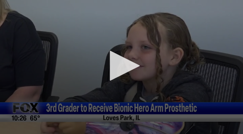 3rd Grader To Receive Bionic Hero Arm Prosthetic June 11th 2024