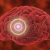 At-Home Brain Stimulation Treatment Can Safely Ease Depression