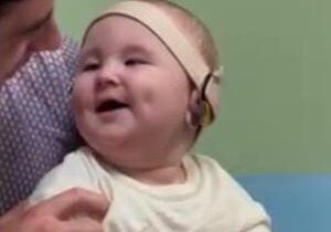 Moment baby born deaf hears his parents’ voices for first time