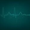 Ablation Best Treatment for Rapid Heartbeat in Heart Attack Survivors