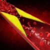 About 1 in 10 U.S. Adults Have High Cholesterol