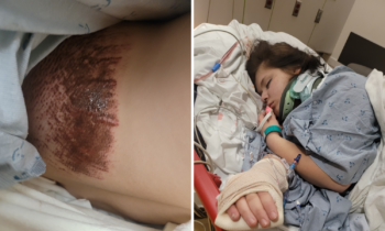 Spokane teen hospitalized after hit-and-run, police searching for suspect