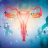 AI Proves Useful for Ovarian Cancer Diagnosis